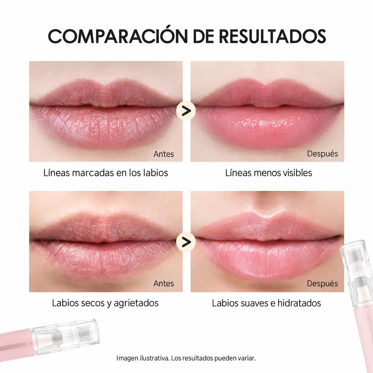 LIPBOOST