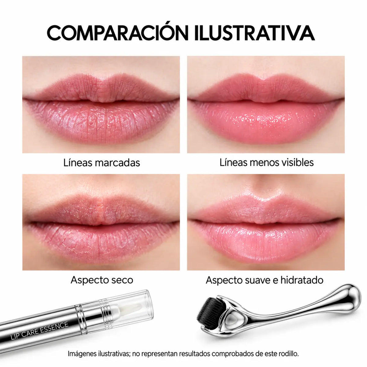 Sistema de aumento labial Glory Smile