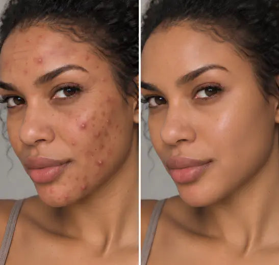 Dr. DRAWING Skin Booster
